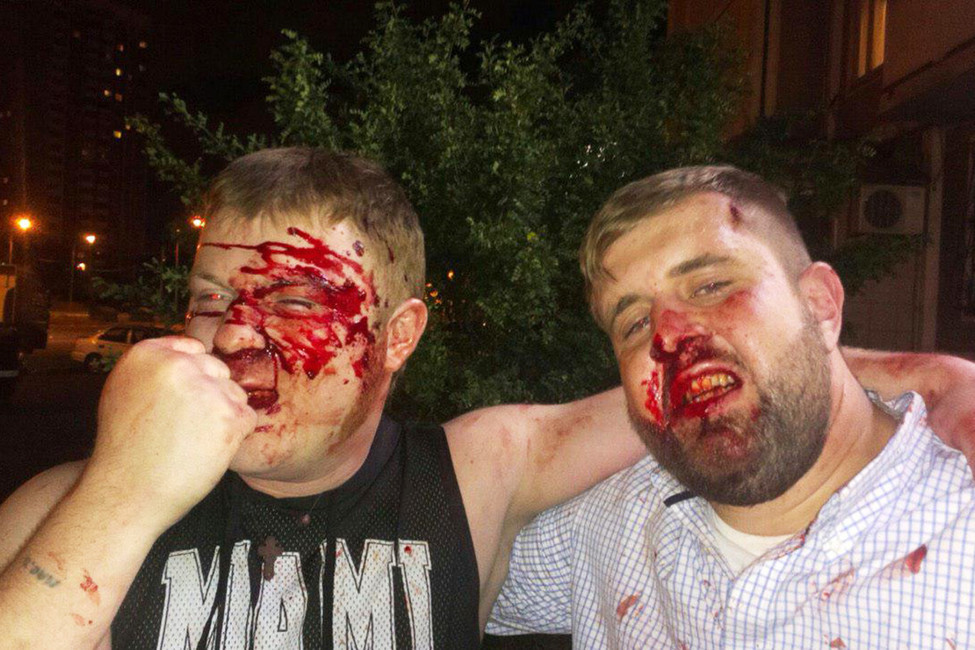 Избивший журналиста НТВ на праздновании Дня ВДВ оказался активистом движения «Сорок сороков»