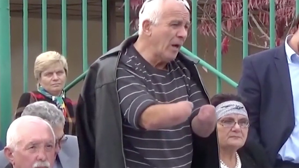 В Нальчике завели дело о нападении на полицейского в отношении активиста, у которого нет кистей рук